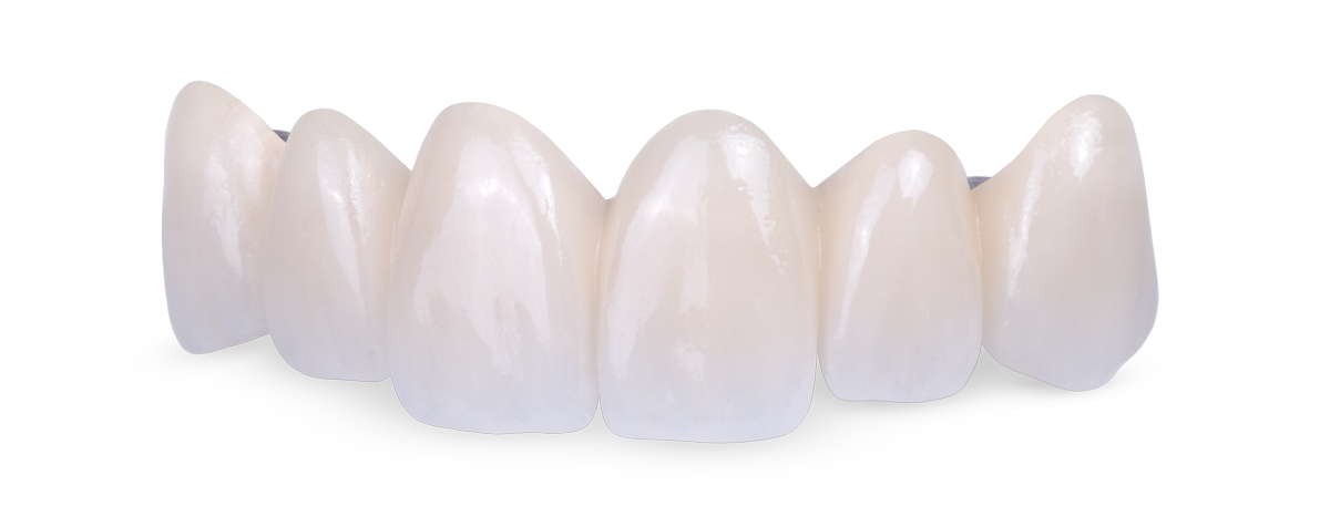 Zirconia Restorations
