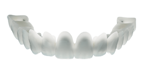 Temporary Restorations